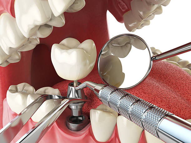 Best Emergency Care for Gum Disease in Bradford Woods, PA
